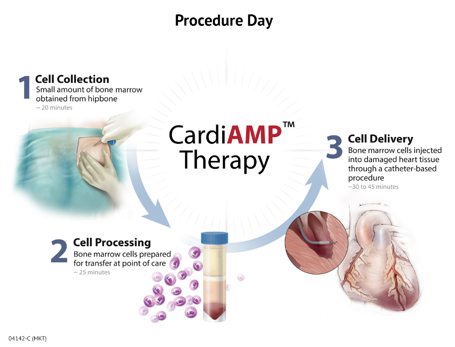 BioCardia Submits Clinical Trial To FDA For New Indication Of Chronic ...