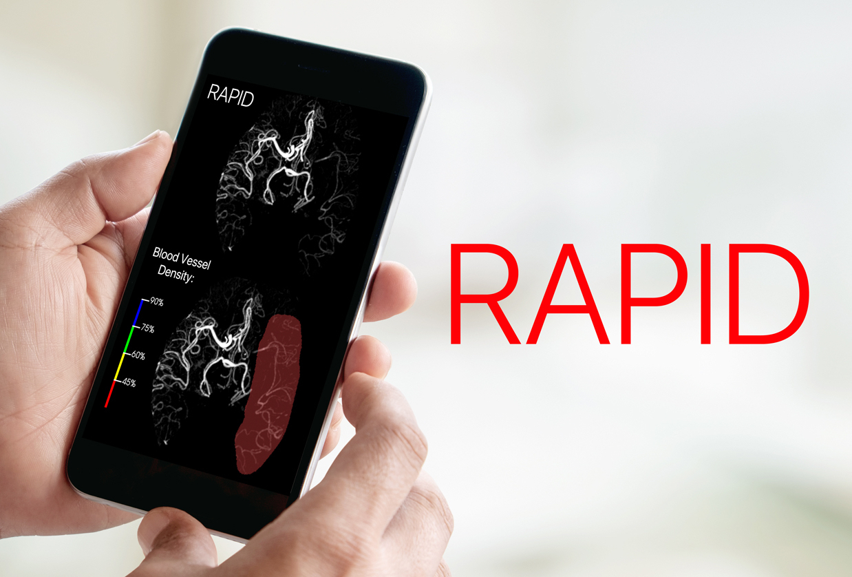 iSchemaView RAPID™ Integrates with Join, Allm’s Medical Communications ...