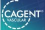 Cagent Vascular Initiates the Serranator® POINT FORCE Observational Registry