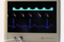 PercAssist’s PSCA System – Intrapericardial Mechanical Circulatory Support (MCS) System for Cardiogenic Shock Presented at the TCT24