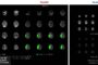 New Study Finds RapidAI Significantly Outperforms Viz.ai in Detecting Medium Vessel Occlusions in Stroke Patients