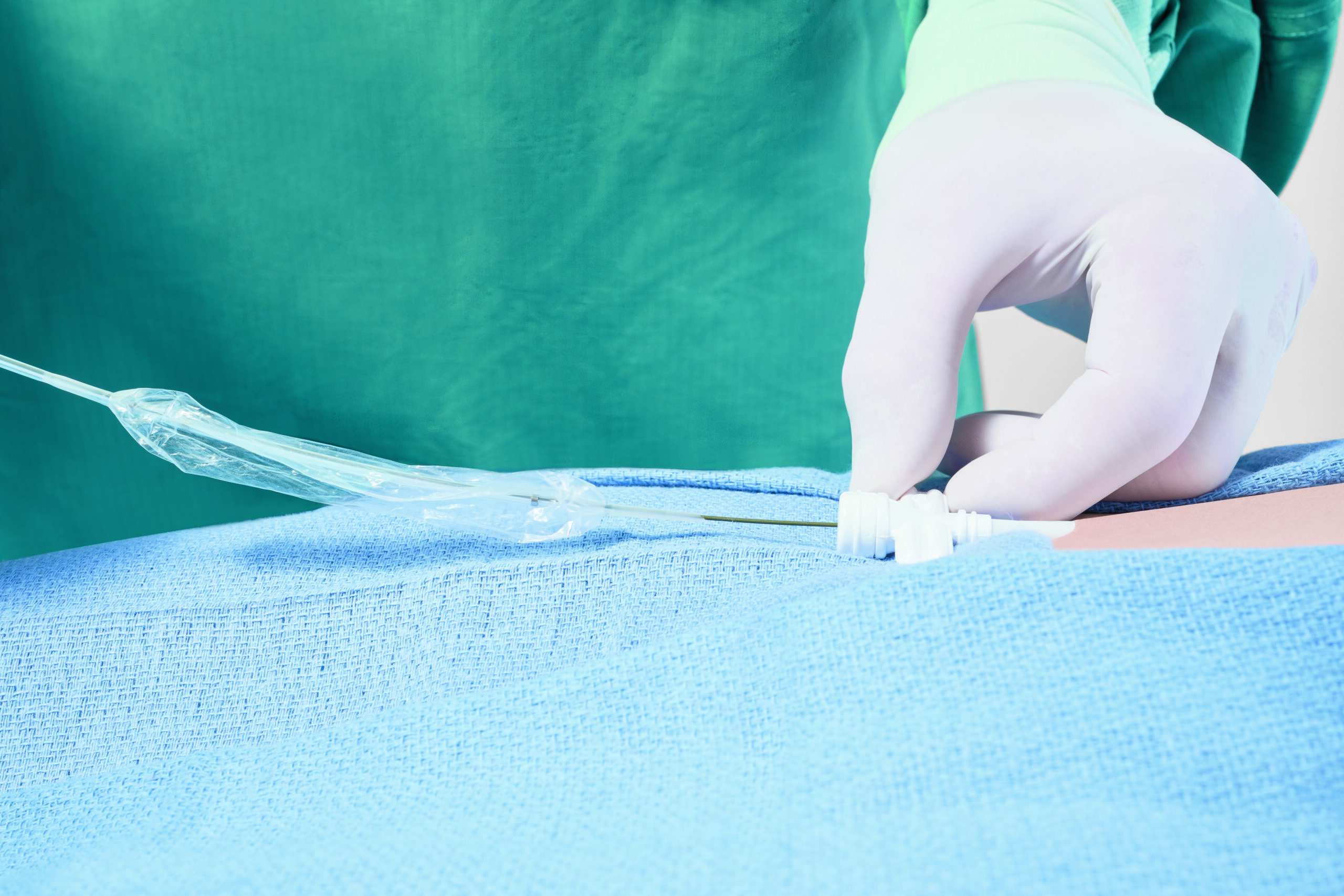 The Philips Bridge Plus Balloon, uninflated prior to use