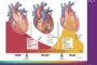 New HFSA Scientific Statement Provides Practical Guidance for Managing Heart Failure with Mildly Reduced Ejection Fraction