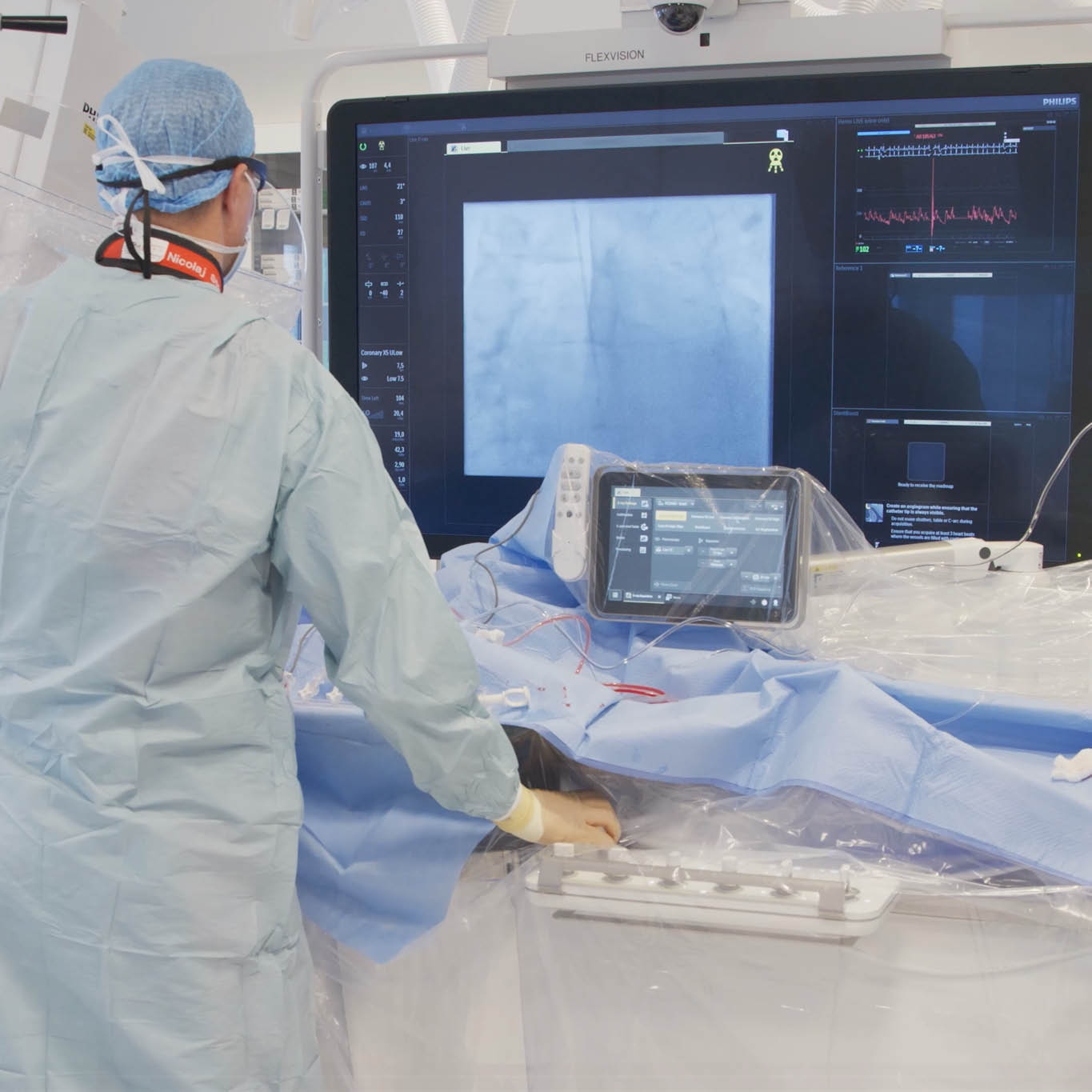 Physicians are using Philips Azurion with SmartIQ technology during an medical procedure.