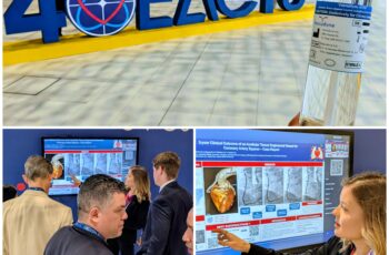 Vascudyne presents at EACTS 2026 in Barcelona. Abby Krouse describes research to attendee.