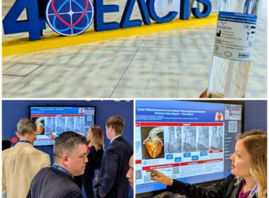 Vascudyne presents at EACTS 2026 in Barcelona. Abby Krouse describes research to attendee.