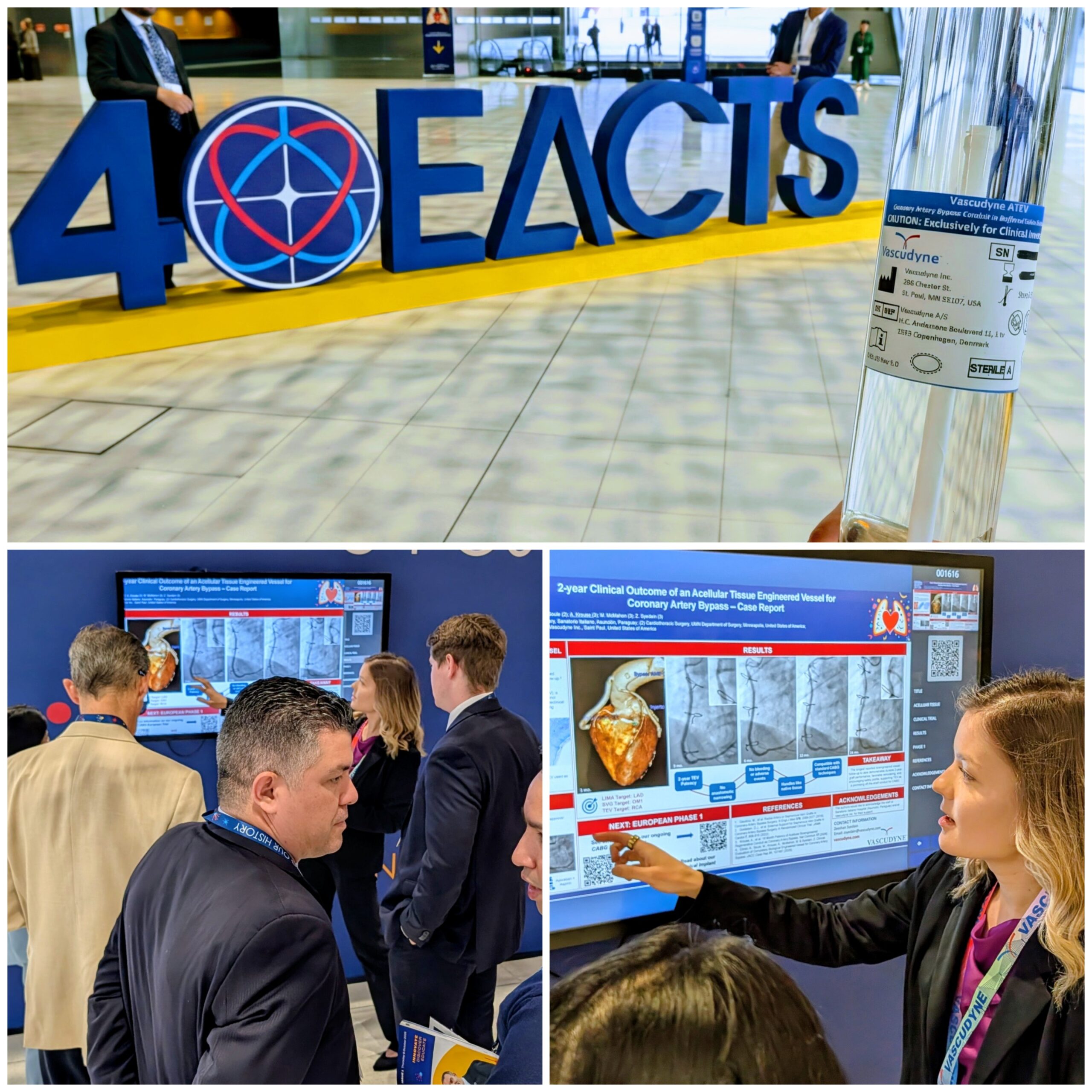 EACTS Vascudyne Photos Vascudyne presents at EACTS 2026 in Barcelona. Abby Krouse describes research to attendee.