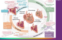 Heart failure society of america image