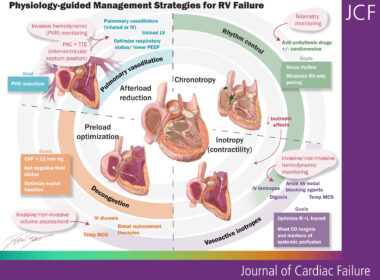 Heart failure society of america image