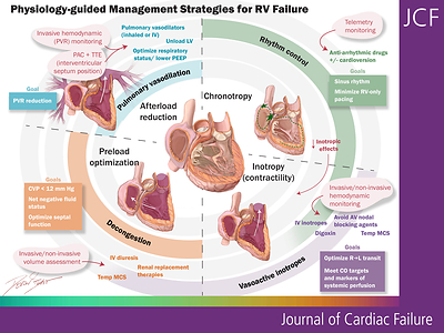 Central Illustration. Physiology guided management strategies for right ventricular(RV)failure. AV,aortoventricular;CO,cardiacoutput;CVP,centralvenouspressure;IV,intravenous;LV,leftventricle;MCS,mechanicalcirculatorysupport;PAC,pulmonaryarterycatheter;PEEP,positiveendexpiratorypressure;PVR,pulmonaryvascularresistance;RV,rightventricle;TTE,transthoracicechocardiogram.
